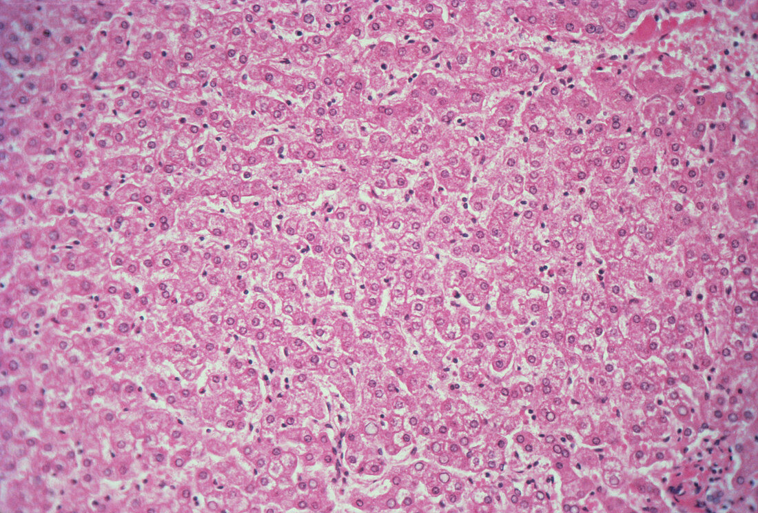 LM of a section of human liver showing lobule