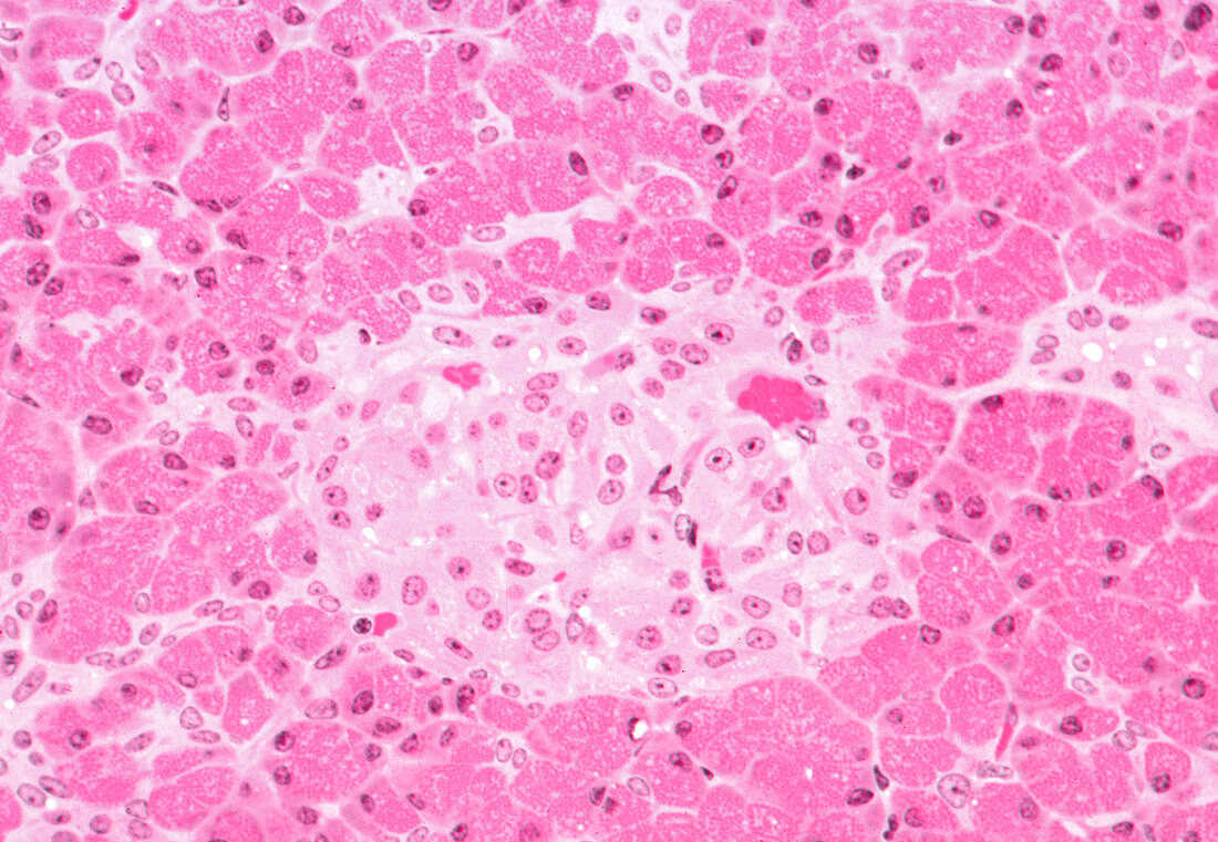 Primate Pancreas