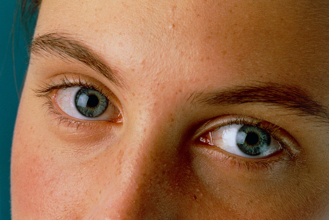 Teenager's face showing her two blue eyes