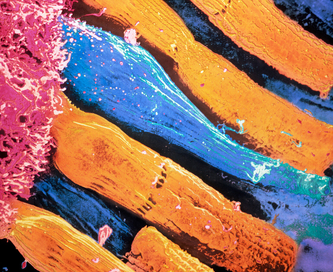 False-colour SEM of rod & cone cells in the retina