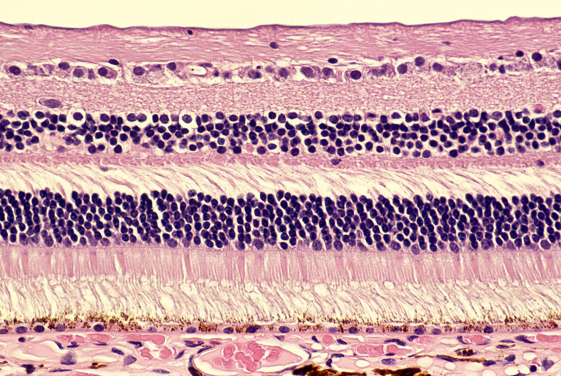 Histology of normal retina