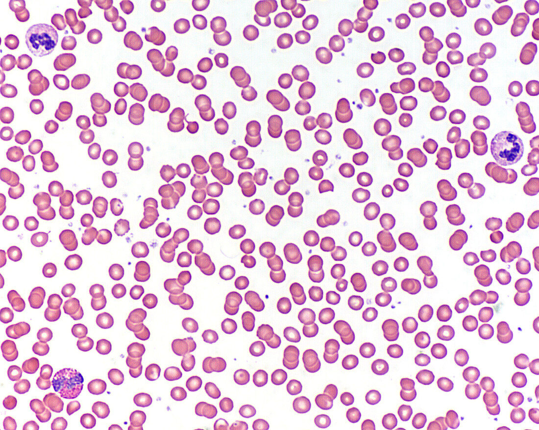 Blood smear