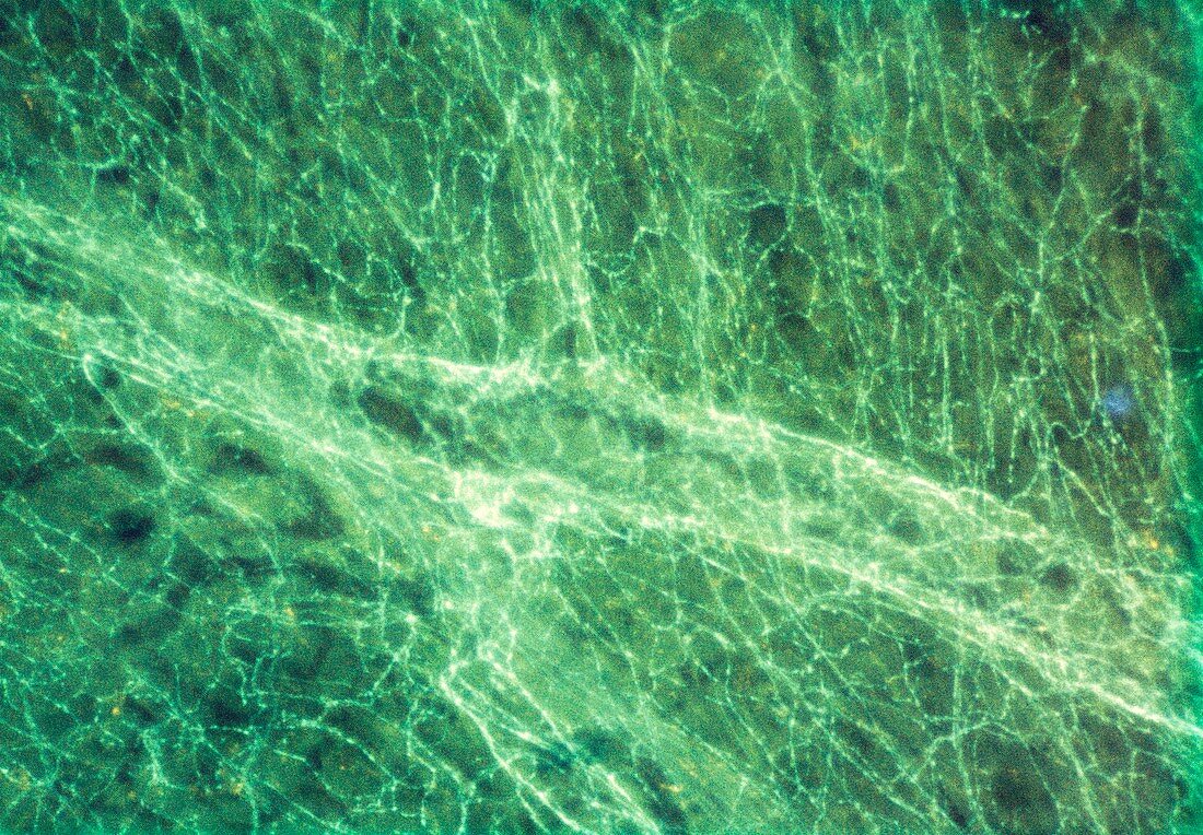 Nerve fibres in eye muscle of rat