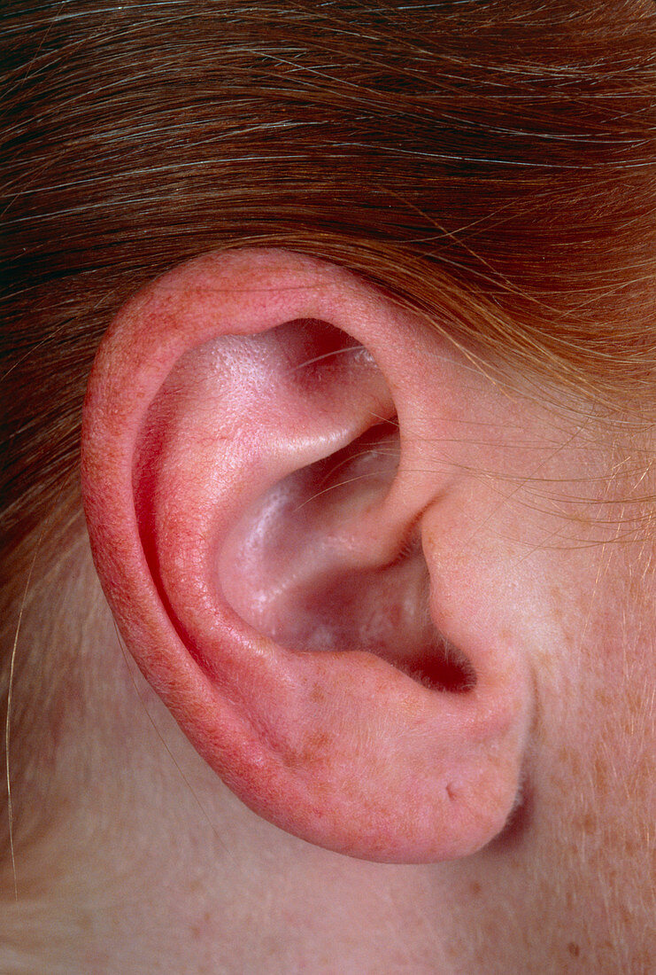 View of woman's right ear pinna (auricle)