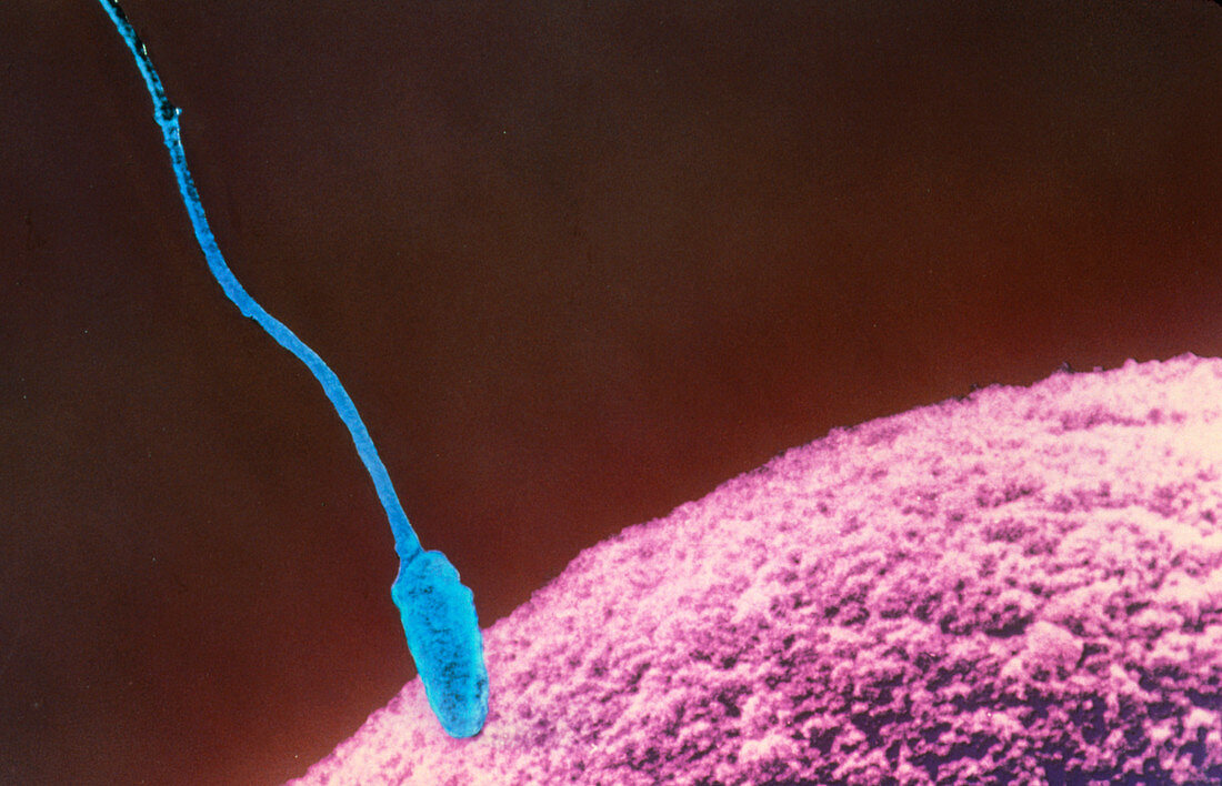 Coloured SEM of sperm & egg during fertilisation