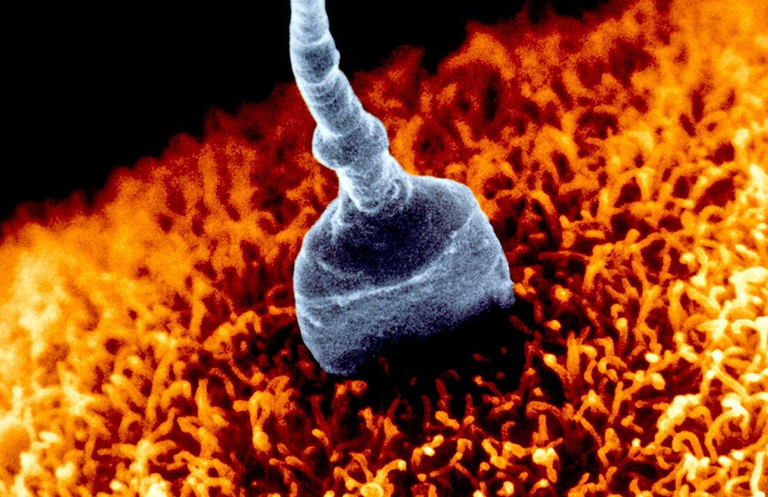 Coloured SEM of sperm on egg during fertilisation