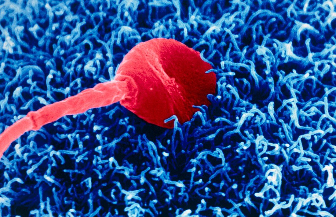 Coloured SEM of sperm on egg during fertilisation