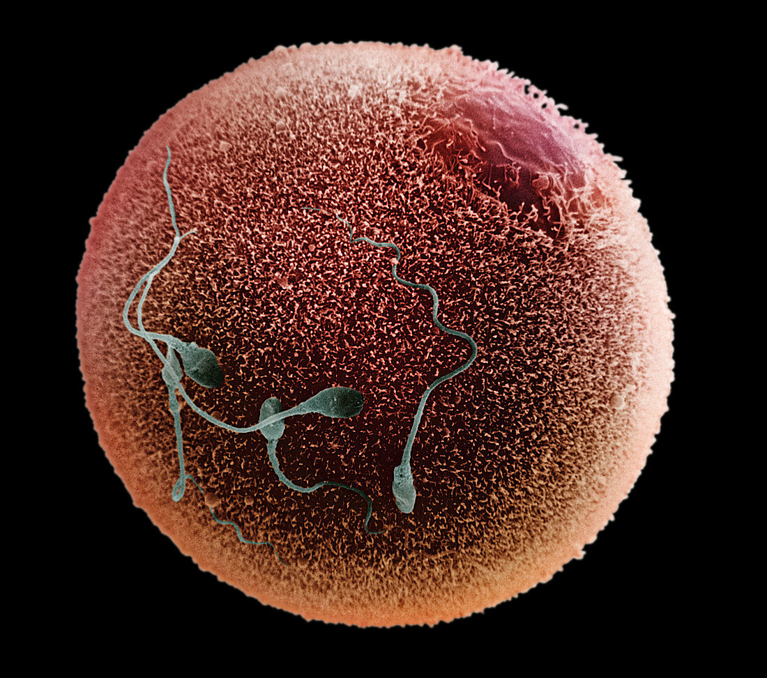 Human Spermatozoa Fertilizing an Egg