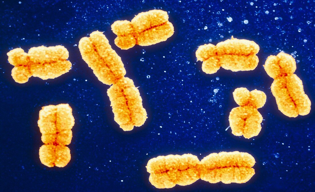 Coloured SEM of a group of human chromosomes