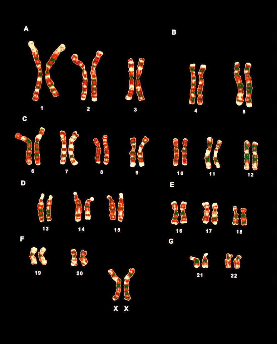 Female human chromosomes