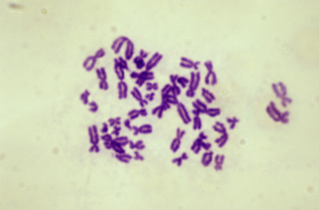 Chromosomes