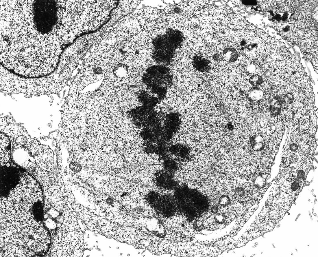 TEM of metaphase cell division of a HeLa cell