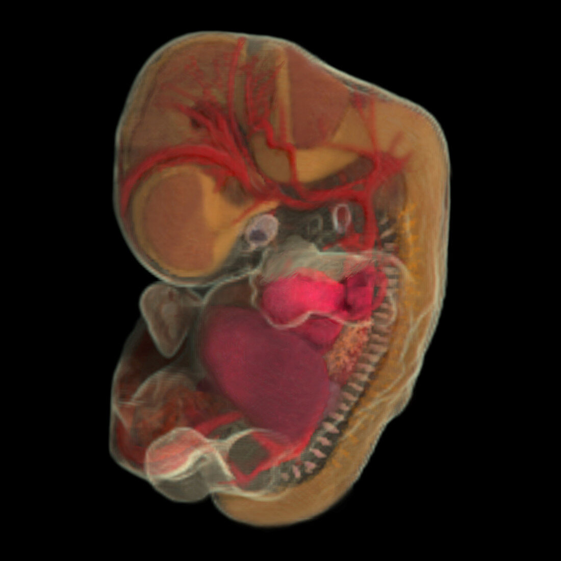 44-day-old Embryo (Micro-MRI)