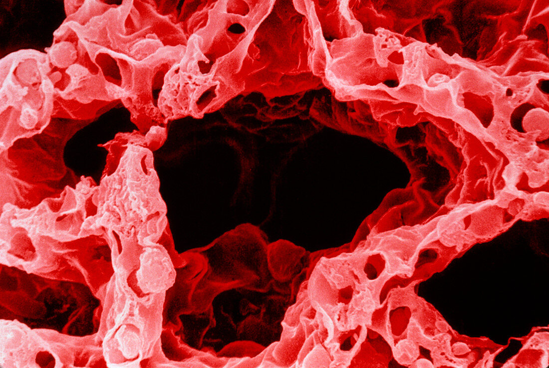 Alveolus in lung