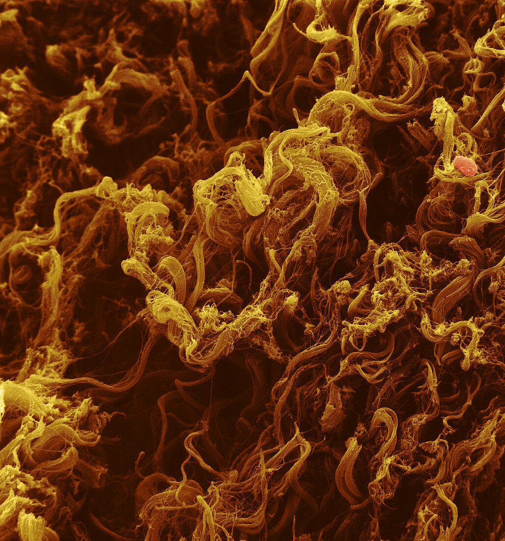 Collagen fibers