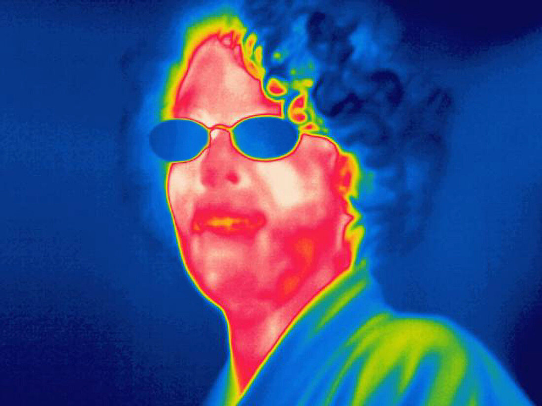 A thermogram of a woman with glasses