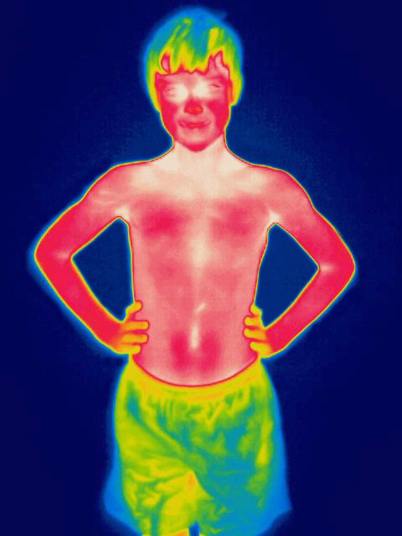 A thermogram of a young boy in shorts