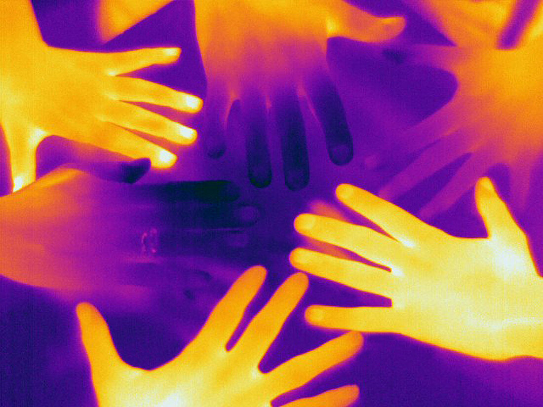 Thermogram of a Different Hands