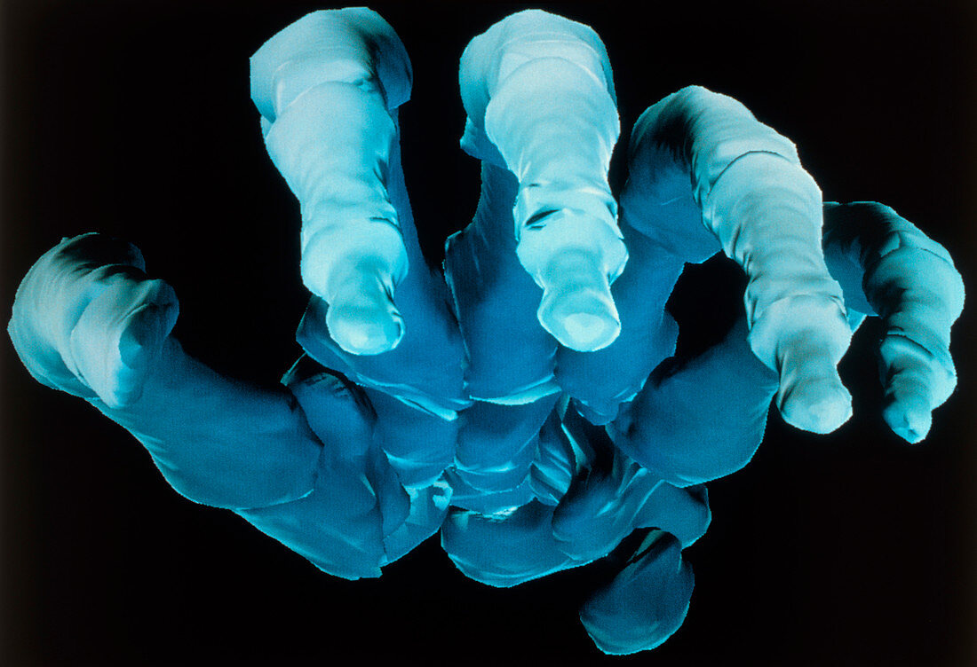 Contour mapping: 3-D CT scan image of a human hand