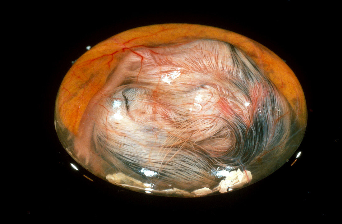 Chick Embryo on 17th Day
