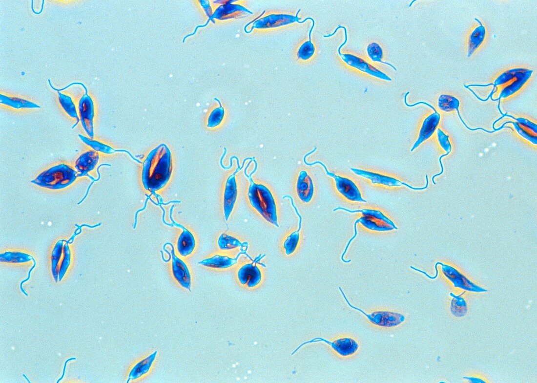 LM of the parasitic protozoa Leishmania donovani