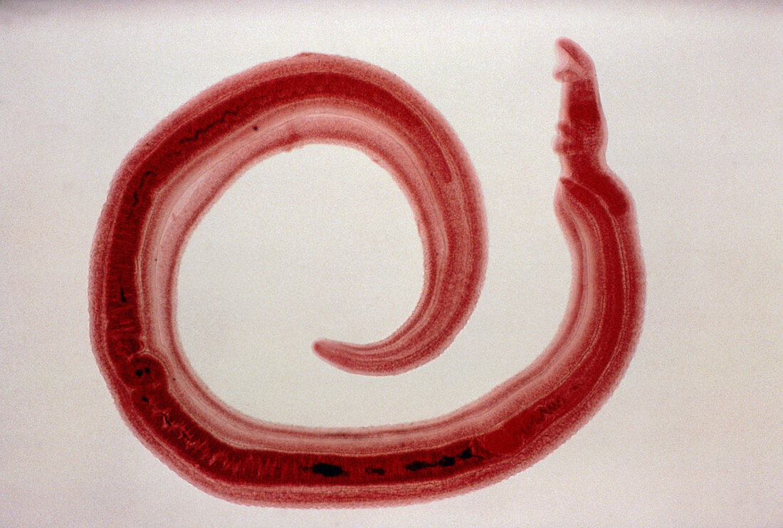 LM of Schistosoma mansoni,bilharzia fluke