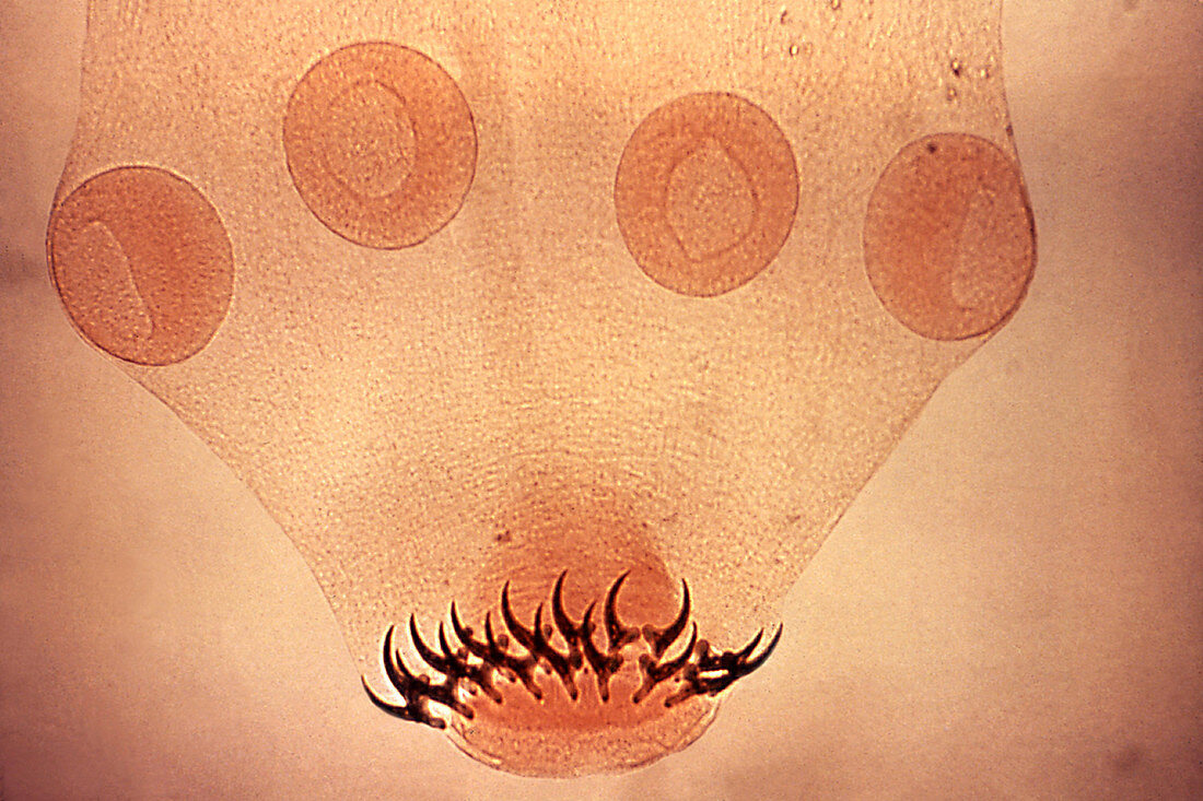 Taenia Solium Tapeworm