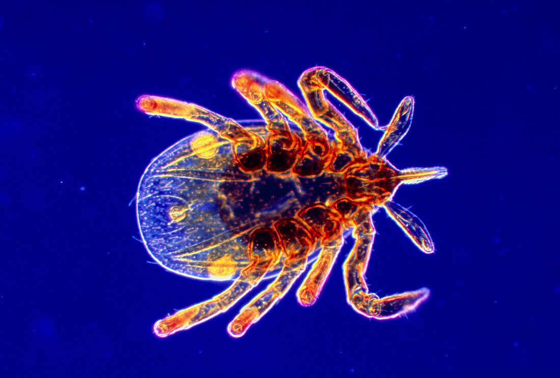 LM of a Lyme disease tick nymph,Ixodes dammini