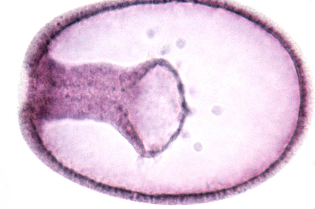 Starfish embryo