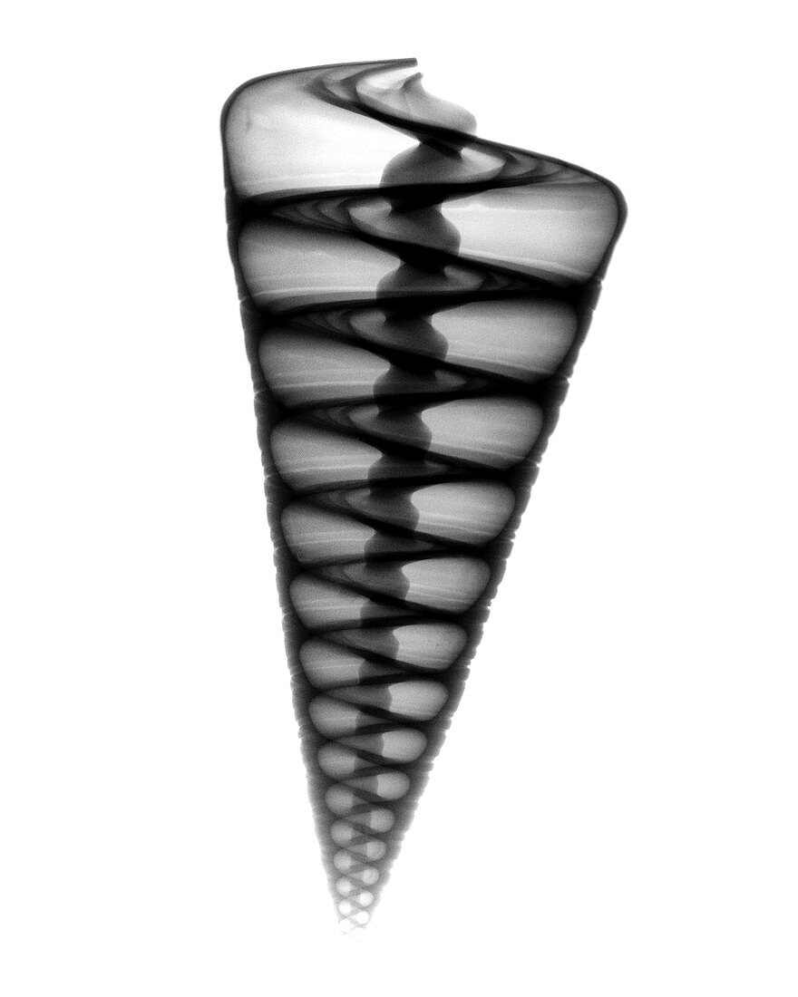 X-ray of Top Shell