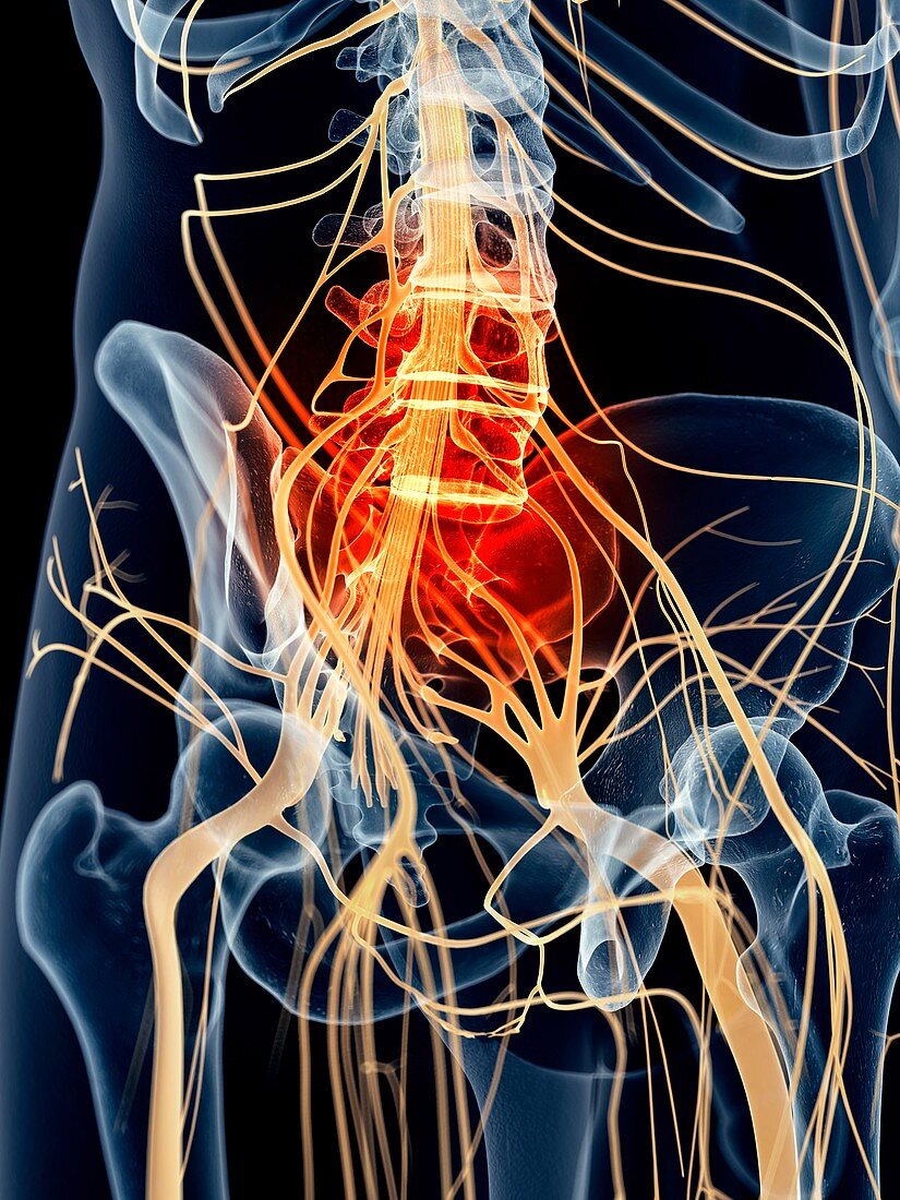 Sacral nerve pain