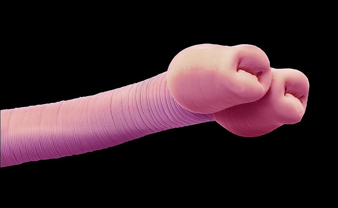 Diphyllobothriidean tapeworm,SEM