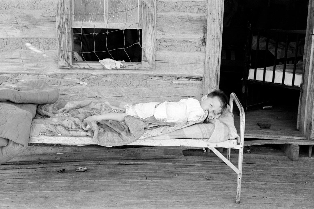 Child with spinal tuberculosis,1939