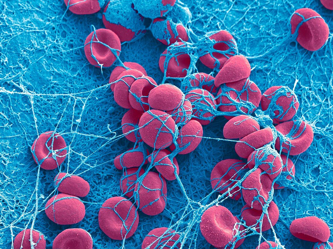 Clot forming in lung tissue,SEM