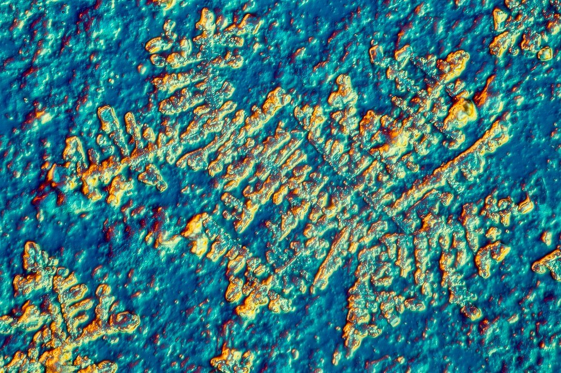 Dried human tear,light micrograph