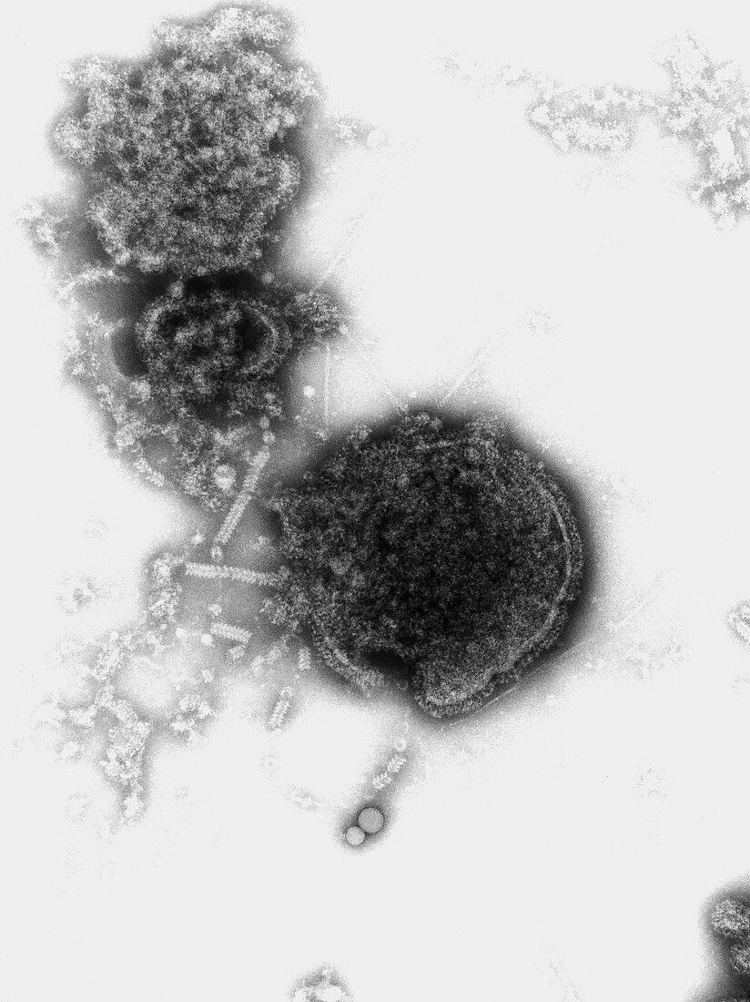 TEM of measles virion with viral nucleoprotein