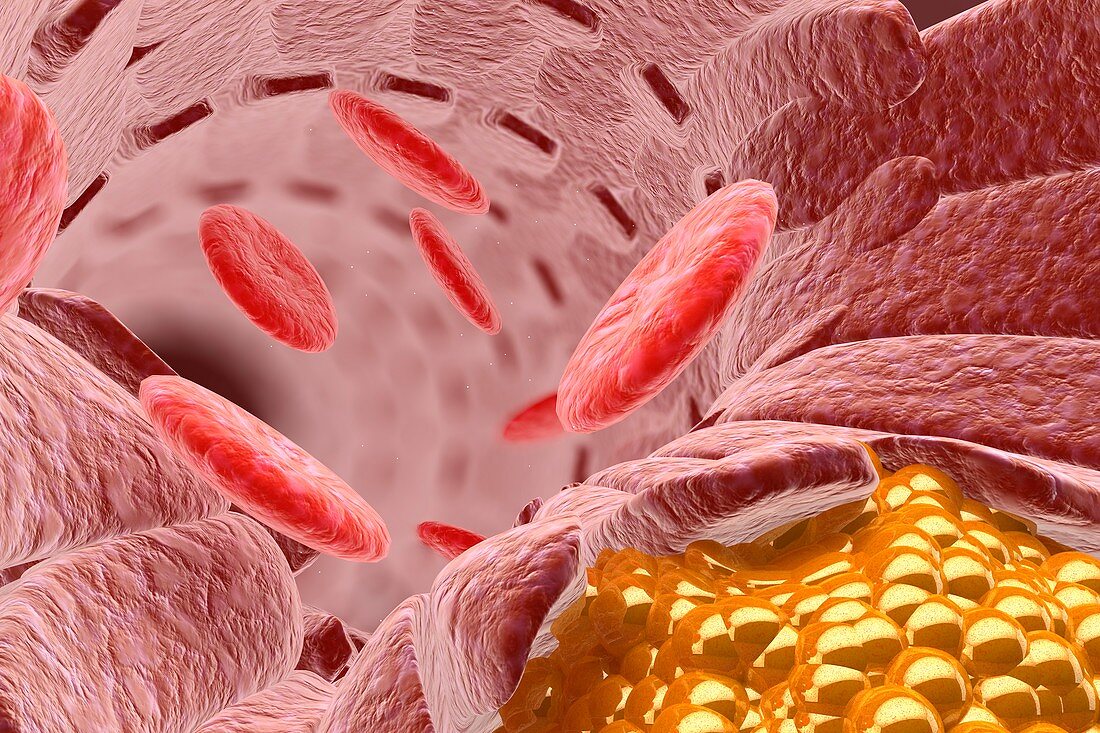 Cholesterol and blood cells,illustration