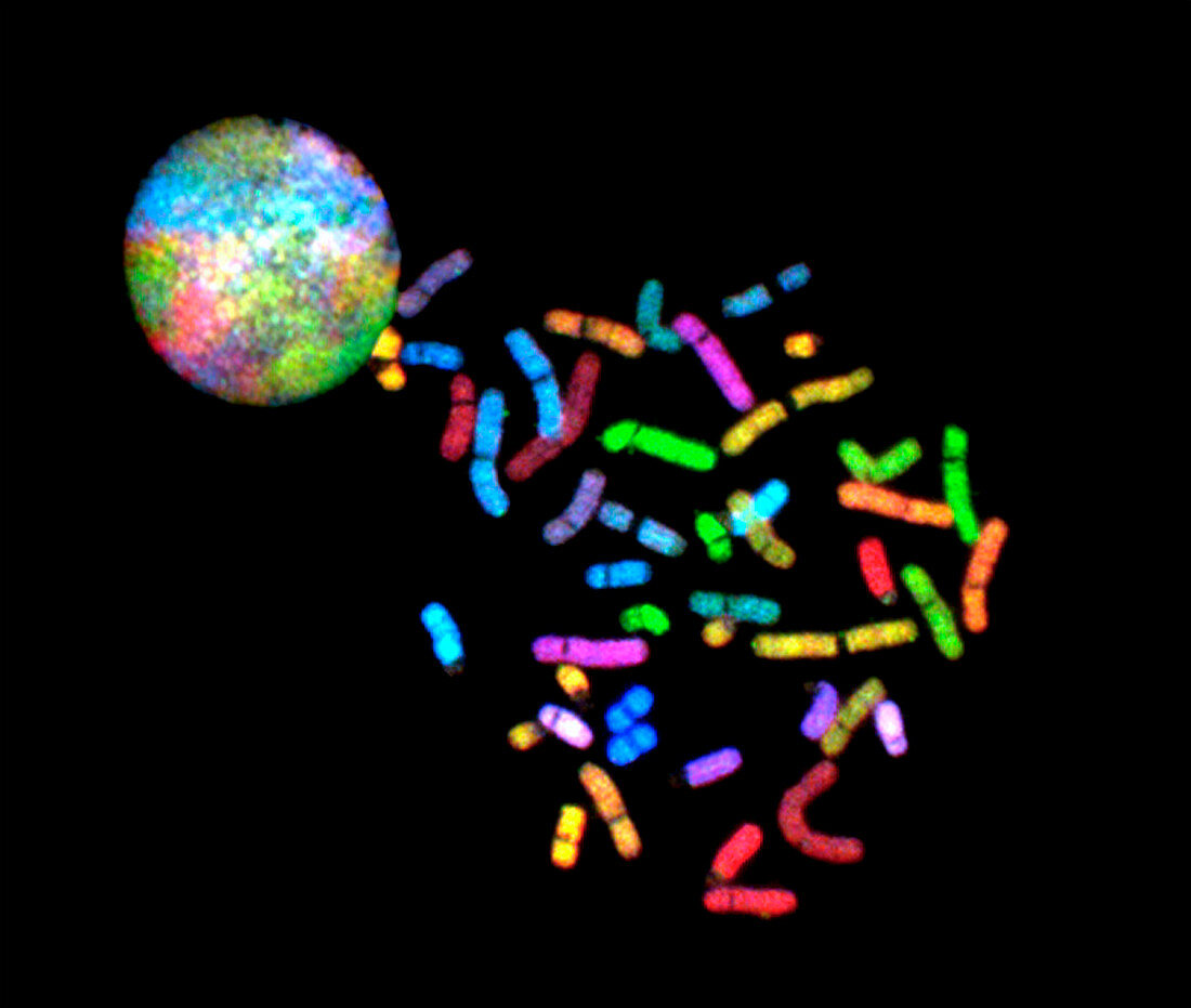 Chromosomes, spectral karyotyping