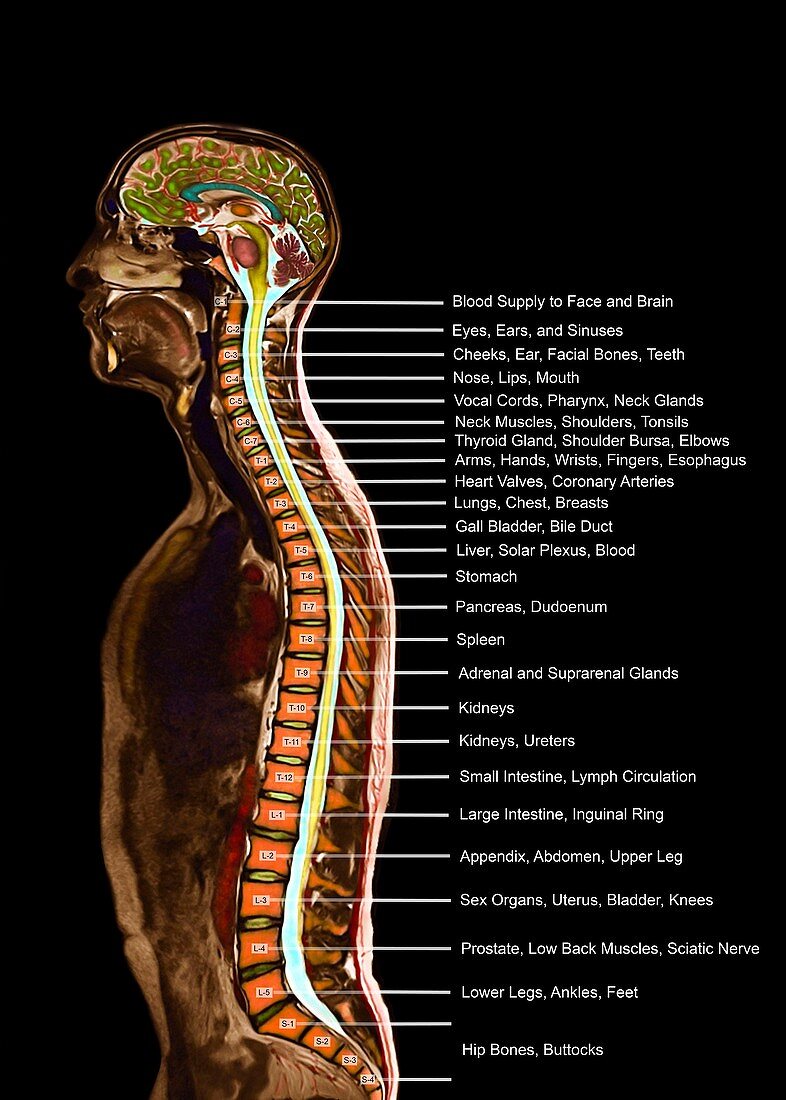 Spinal nerve levels, sagittal MRI