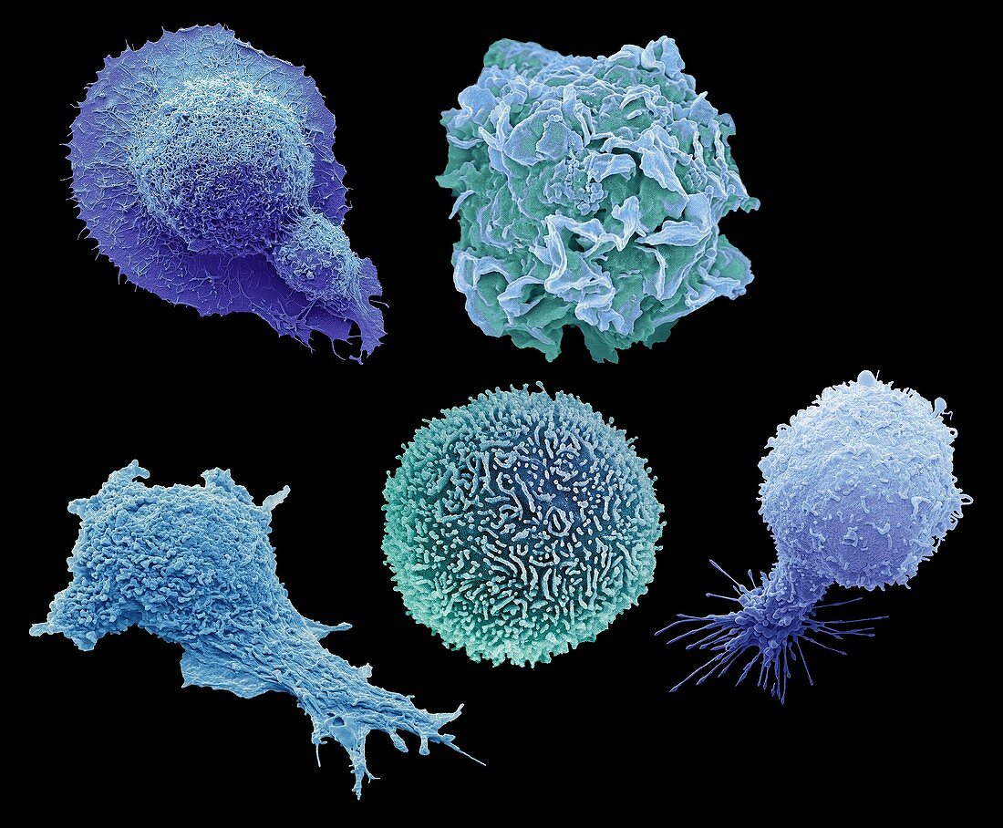 Cells from cancers with highest mortality rates, SEM