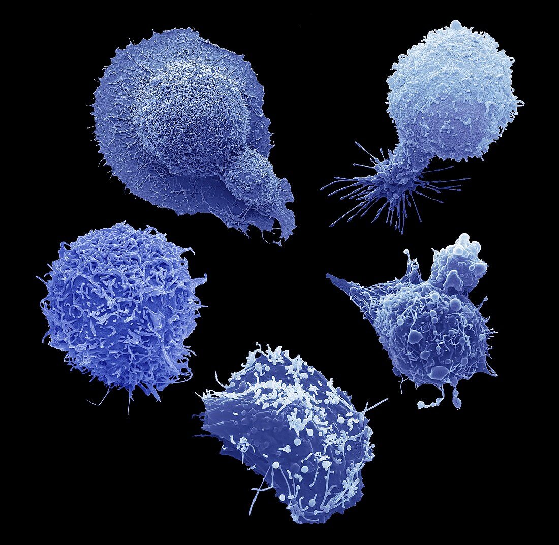 Cells from the most common male cancers, SEM