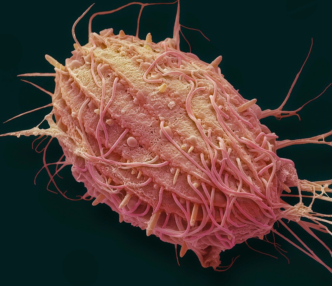 Marine ciliate protozoan, SEM