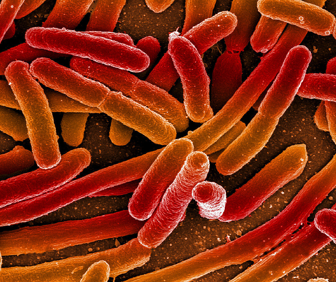 Escherichia coli, SEM