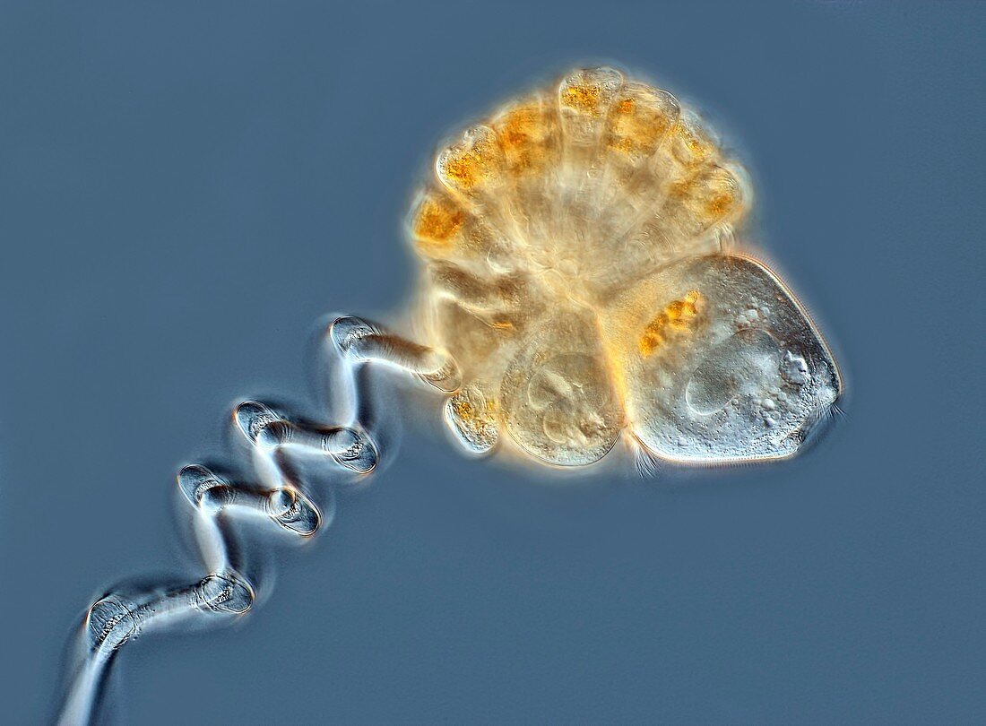 Apocarchesium protozoa colony, light micrograph