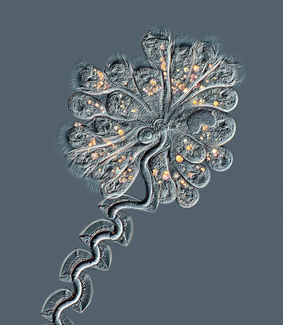 Apocarchesium protozoa colony, light micrograph