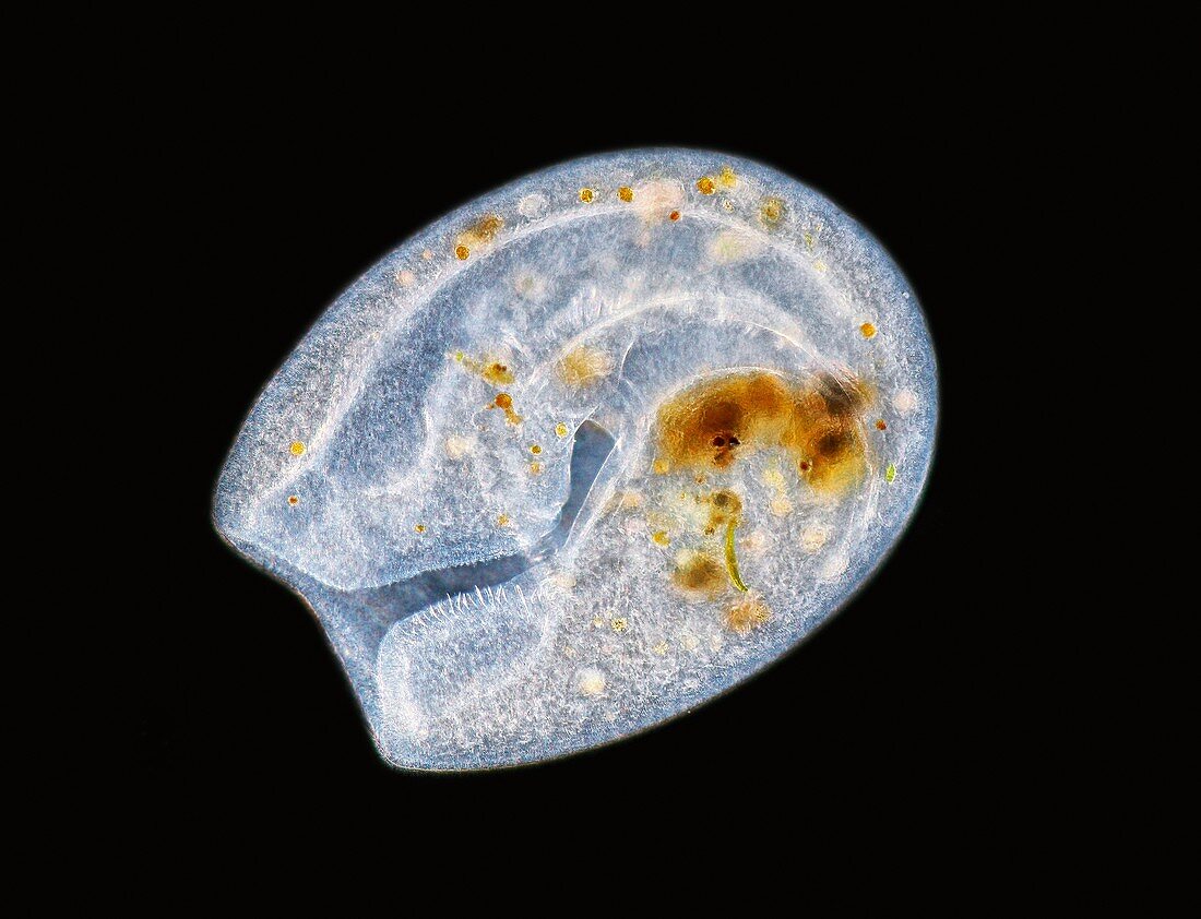 Bursaria protozoan, light micrograph