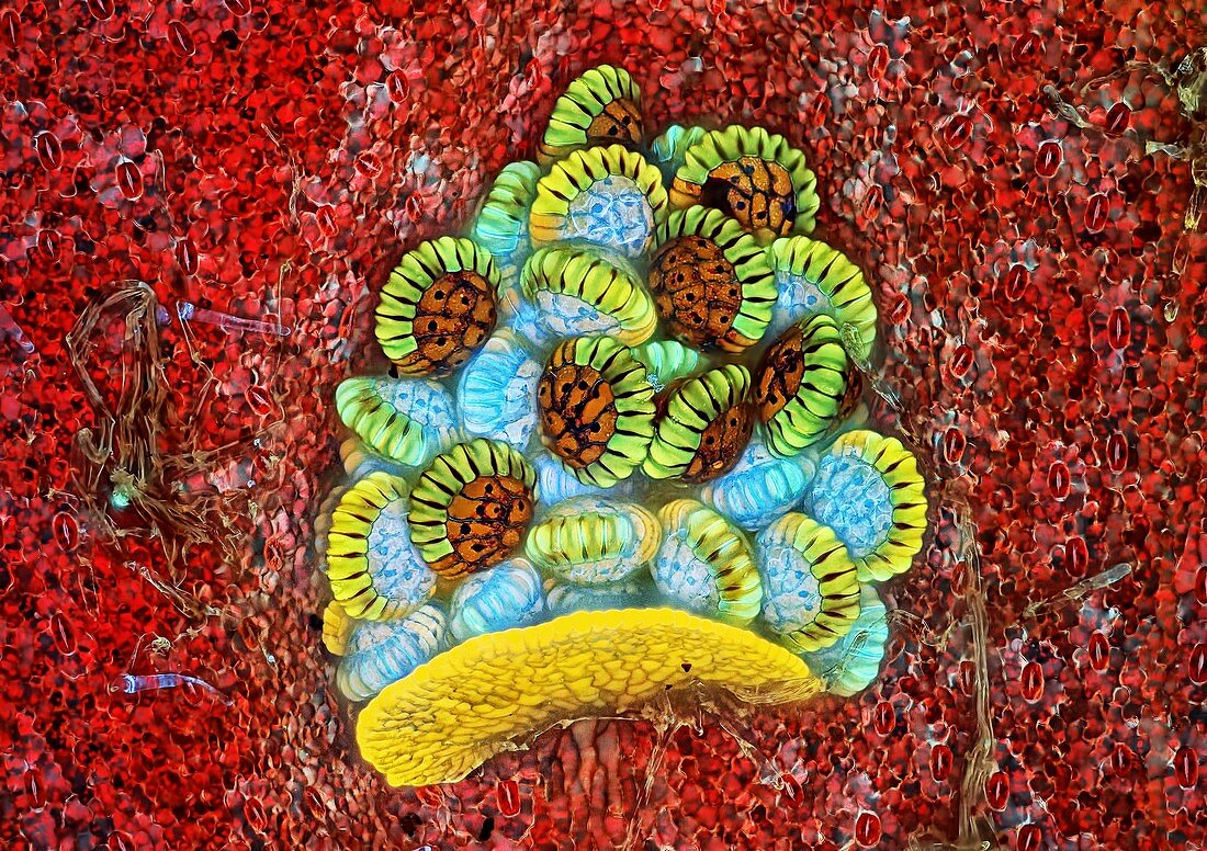 Fern sorus, fluorescence light micrograph