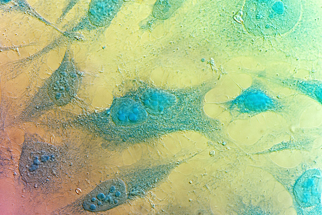 HeLa cells,light micrograph