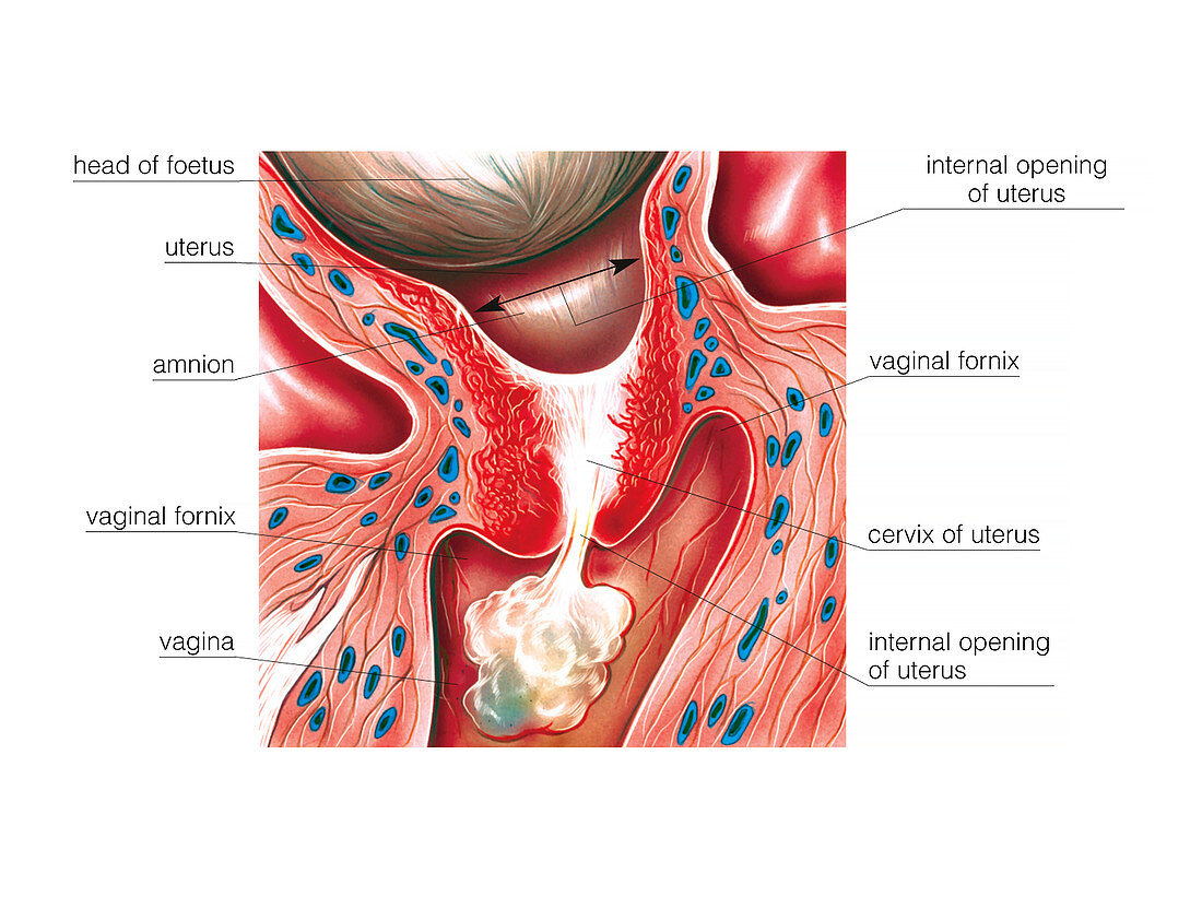 Cervix in pregnancy,illustration