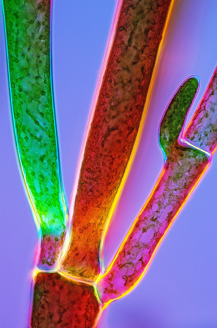 Cladophora green algae,light micrograph